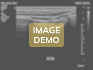 Comparison image - Case AN-ANT-MI-A1097