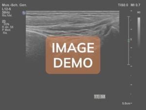 Comparison image - Case AN-ANT-MO-A1098
