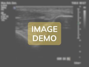 Comparison image - Case EL-ANT-MI-A1129